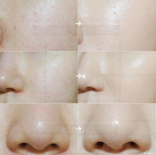 Kem Dưỡng Innisfree Green Tea Balancing Cream Ex